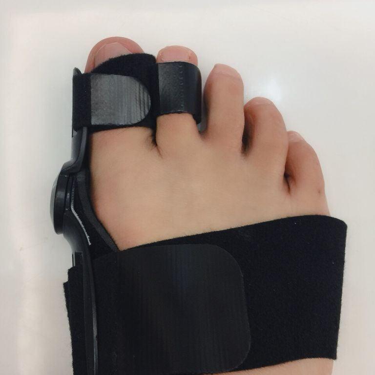 Day and Night Hallux Valgus Orthosis - VitaGlow Beauty Co.