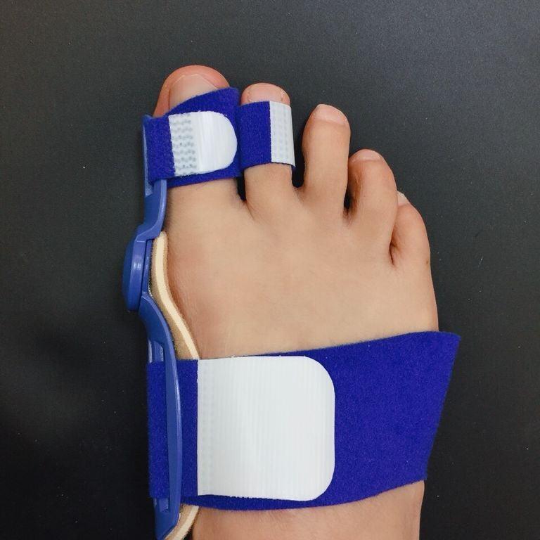 Day and Night Hallux Valgus Orthosis - VitaGlow Beauty Co.