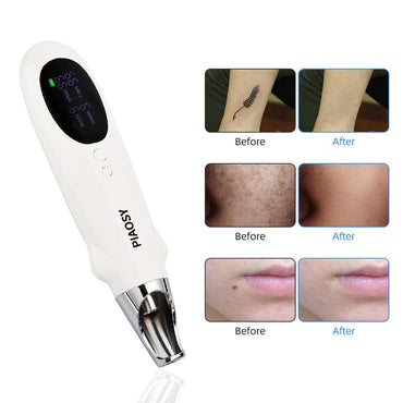 Rechargeable Laser Picosecond Pen for Skin Blemishes and Pigmentation Removal - VitaGlow Beauty Co.